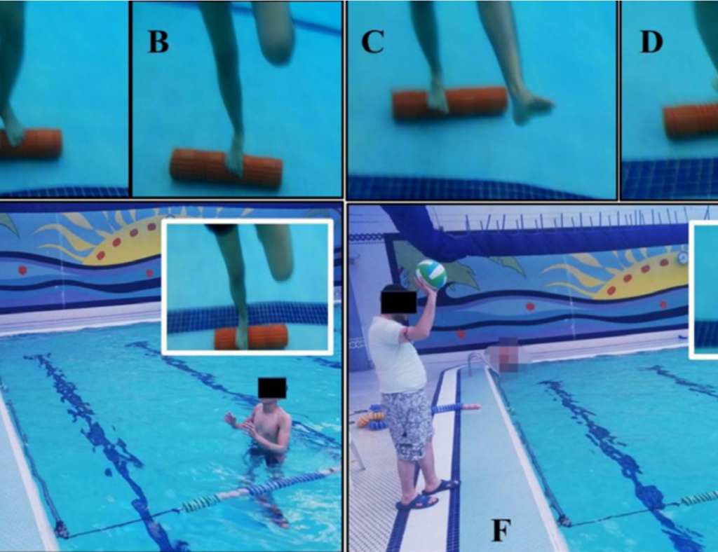 Picture Hajouj (2020) Knee Proprioception in Athletes with Anterior Cruciate Ligament Reconstruction: A Randomized Controlled Trial